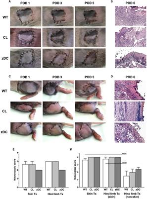 Depletion of donor dendritic cells ameliorates immunogenicity of both skin and hind limb transplants